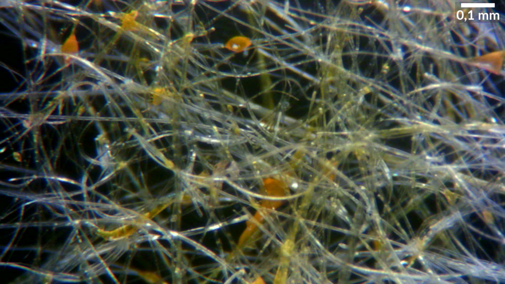 Mikroskopiebild, 1,50 mm x 0,84 mm, ein Geflecht aus weißen durchsichtigen Fasern, mit Durchmessern von ca 0,008 mm, eine Trocpfen von Gelb im Bild